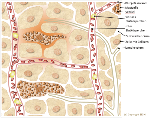 Schematische Zeichnung: Mastzellen im Gewebe Bild: Mastzellen im Gewebe